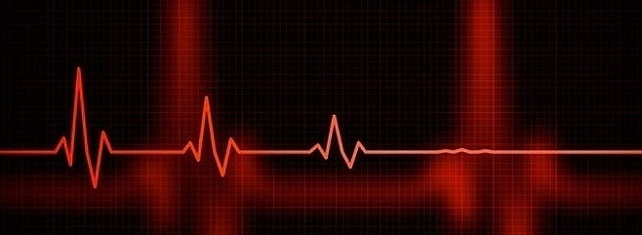 Schwächer werdende EKG-Kurve
