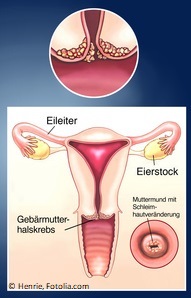 pinworms és zentel phylum platyhelminthes képek név szerint